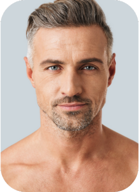 Augenlidstraffung Teaser-Bild