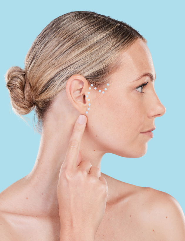 Fadenlifting Technik mit hauchdünnen Fäden